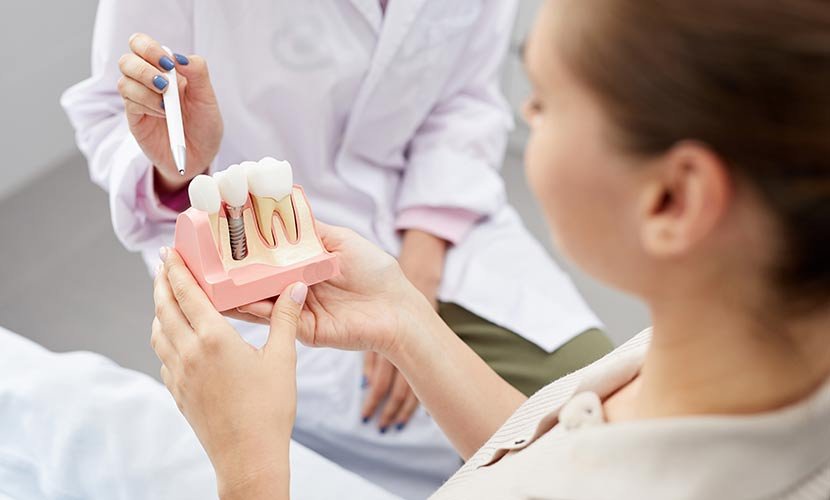 Broxburn Smile Centre – Dental Implants Broxburn Smile Centre - Dental Implants